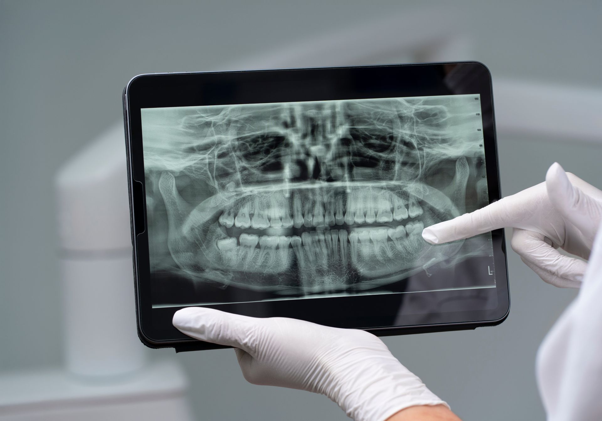 Digital x-rays