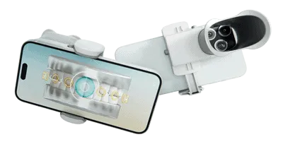 Dental monitoring inner img