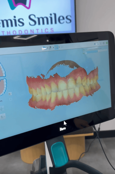 Digital 3D imaging display of a teeth model showing advanced orthodontic exam technology