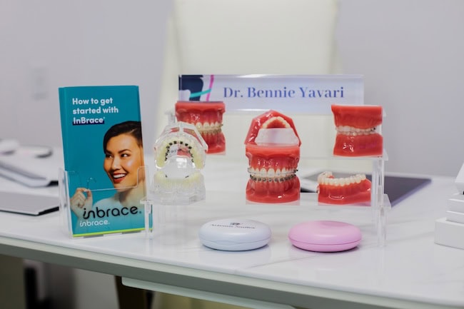 InBrace display with dental models on the front desk at Artemis Smiles Orthodontics