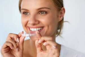 accelerated-treatment-artemis-smiles-orthodontics-atlanta
