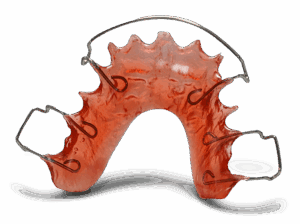 Illustration of a removable retainer with acrylic base and wire.