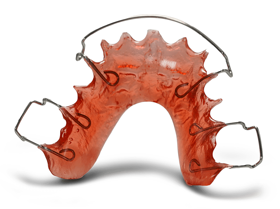 Illustration of a removable retainer with acrylic base and wire.
