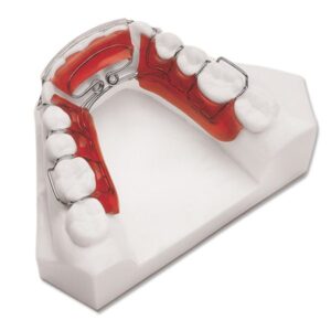 spring retainer